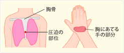 心臓マッサージ